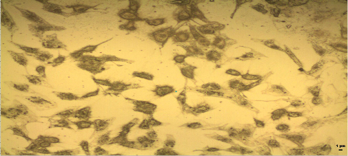Magnified image of multipotent stromal cells/mesenchymal stem cells